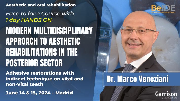 Modern multidisciplinary approach to aesthetic rehabilitations in the posterior sector - Featured image