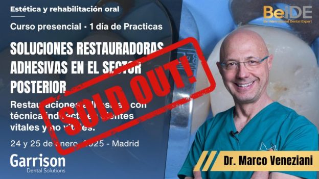 Soluciones Restauradoras Adhesivas en el Sector Posterior - Imagen destacada - Sold out