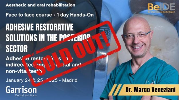 Adhesive Restorative Solutions in the Posterior Sector - Featured Image - Sold out