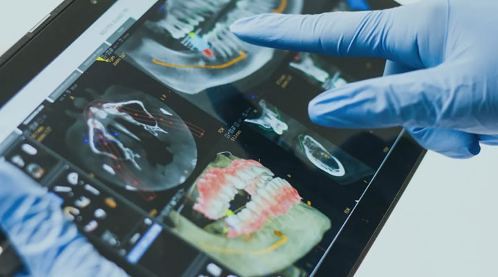 The Multidisciplinary Treatment in the Digital Era - Header card