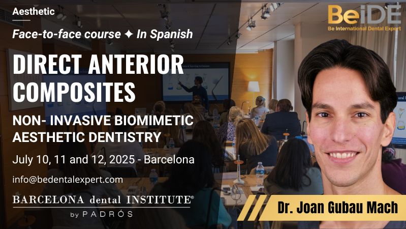 Direct Anterior Composites - Featured image July 2025