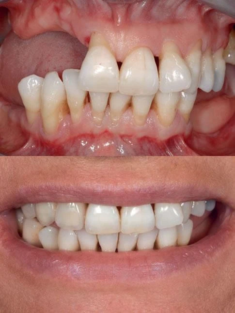 Dr. Roberto Rossi GBR - Clinical case 03