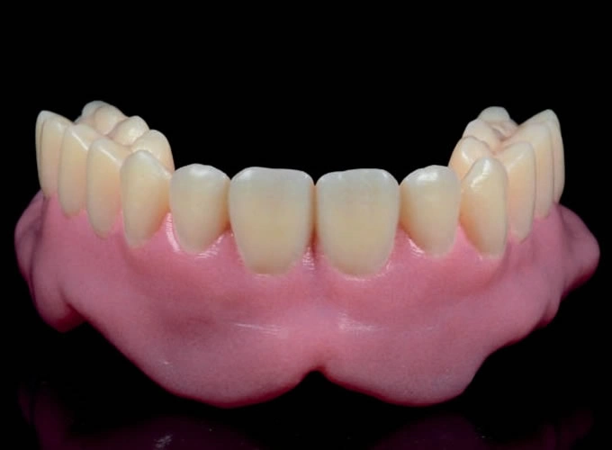 Digital Removable Prosthesis - Content image 04