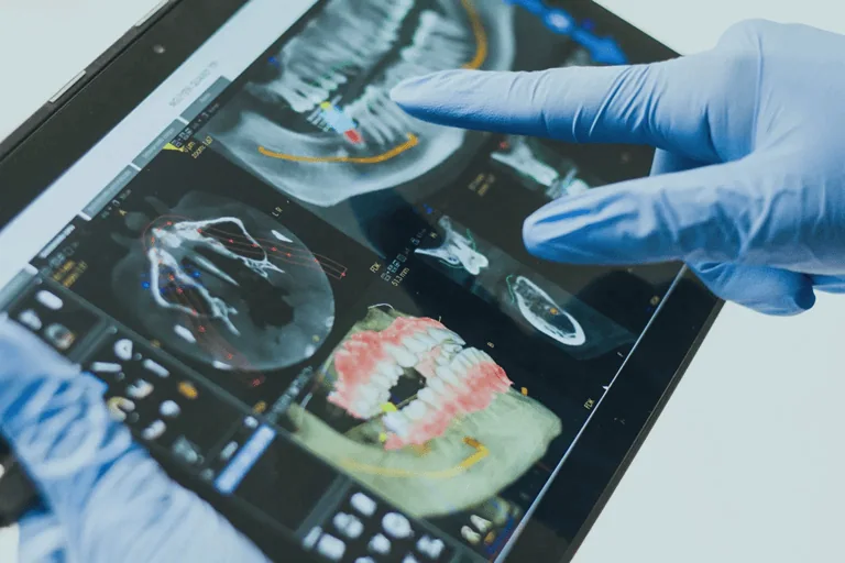 DDS State of the Art Conference - AI-based Dental Imaging Unlocked - Header image