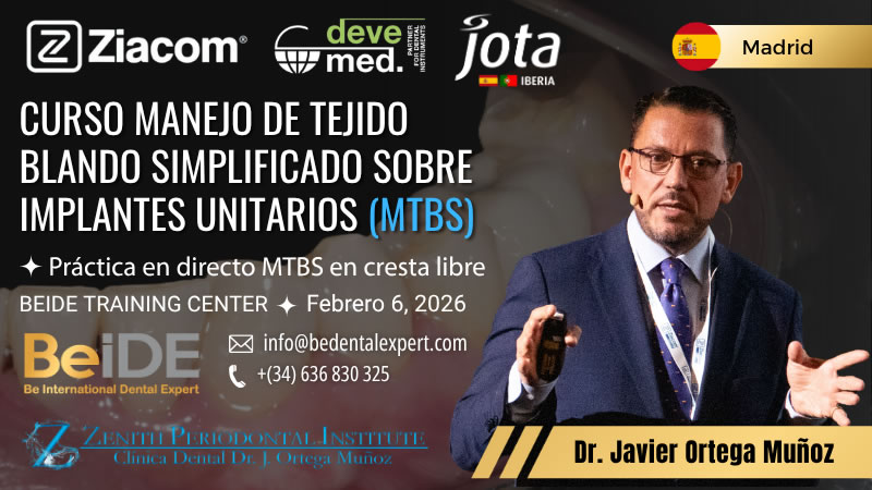 Curso Manejo de Tejido Blando Simplificado sobre Implantes Unitarios (MTBS) - Imagen destacada