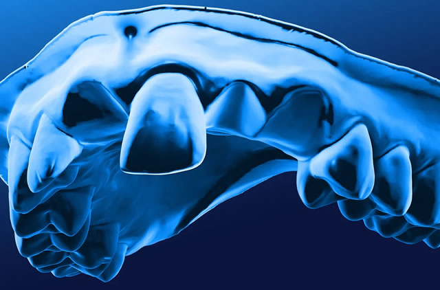 Perform IO scan before prep - DentalTwin image