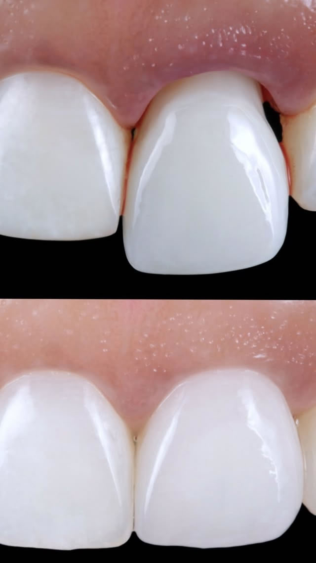 Conceptos Clave en Odontología Restauradora Moderna - Markus Blatz - Imagen 01
